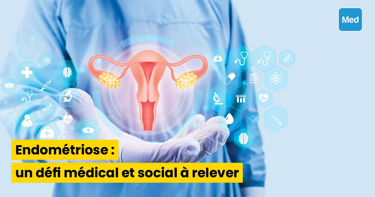 Endométriose : un défi médical et social à relever